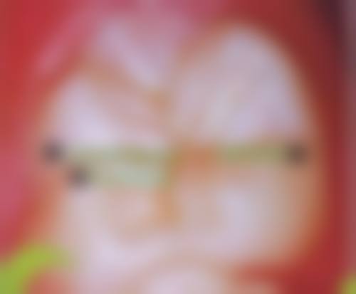 威海尹忠植口腔医院患者真实评价