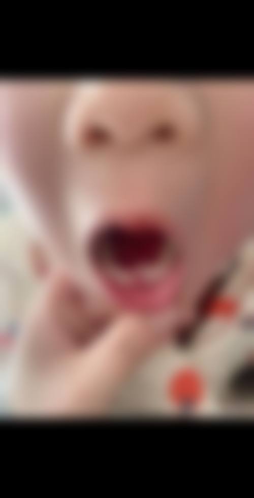 内蒙古包头博洁仕口腔就诊指南