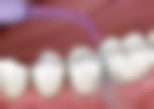 南通如皋金诚口腔透明收费标准