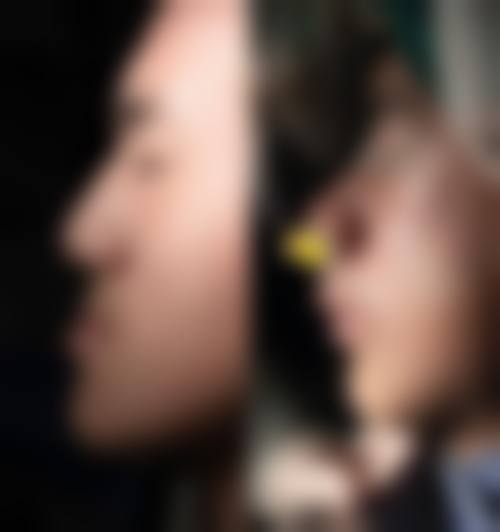 玉溪华宁西瑞口腔门诊部患者真实评价