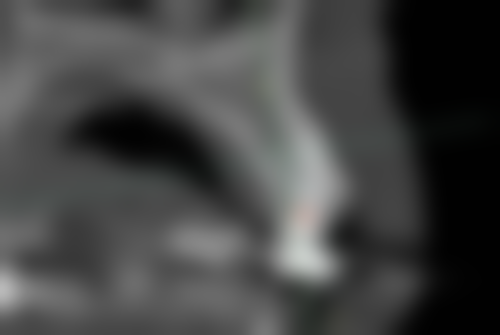 长沙优伢仕口腔(总院)来院指引与预约方式