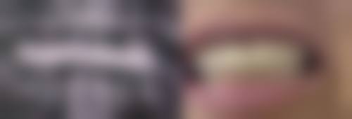 杭州马传金口腔诊所患者真实口碑分享