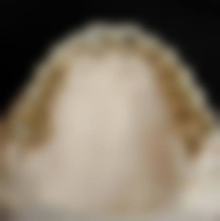 张可娟的临床实战与个性化方案