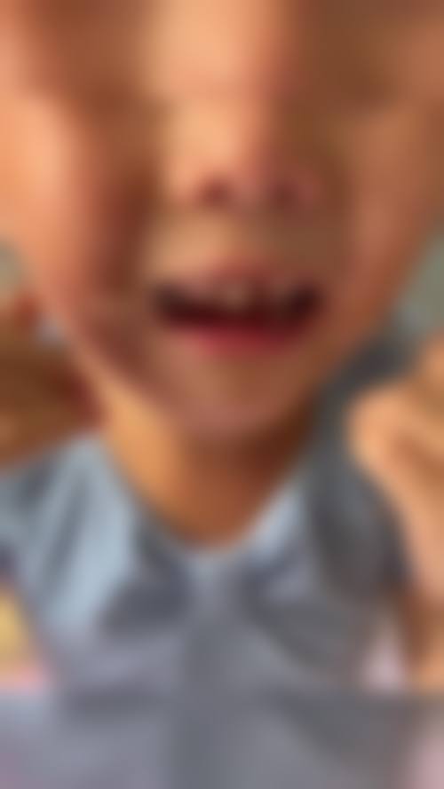 桂林周民霞口腔诊所精良设备与诊疗保护