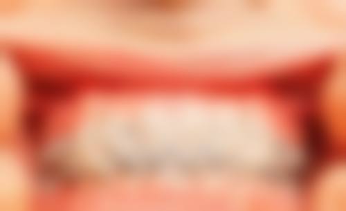 莱州仁爱口腔诊所特色诊疗技术