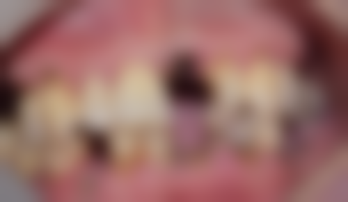 莱州仁爱口腔诊所收费价格参考