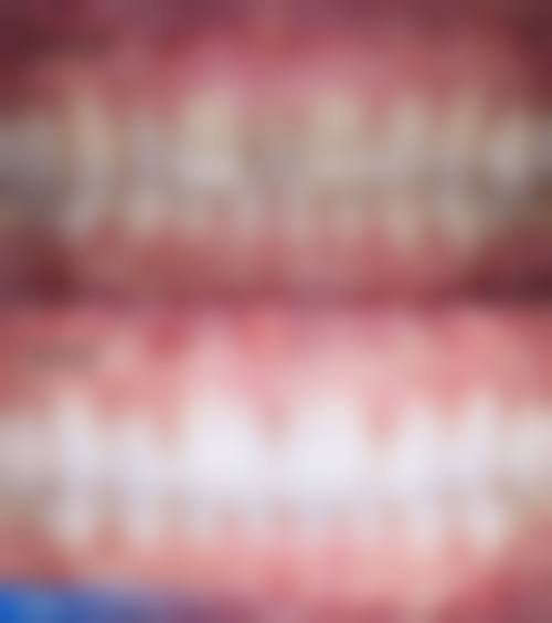 湖北荆门拜耳口腔核心技术优势