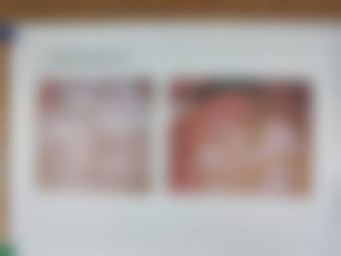 博山乐茗口腔患者真实口碑