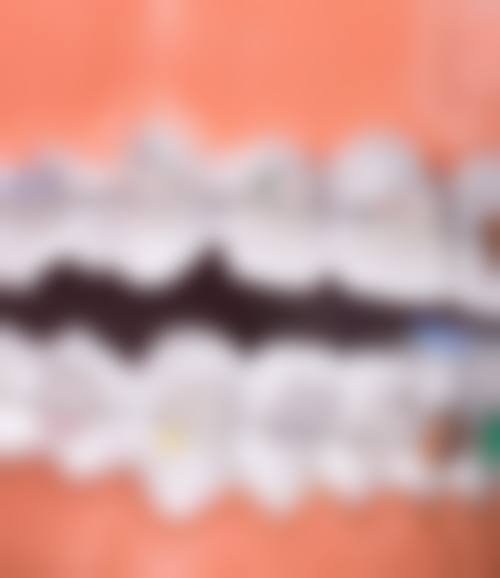 临沂美多口腔收费标准参考