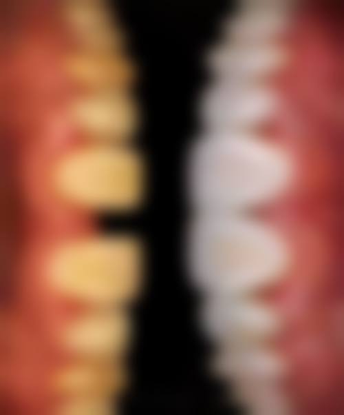 广州美伦口腔(祈福缤纷汇院)患者真实评价