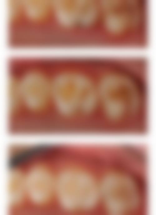 隆回牙卫仕口腔诊所的特色诊疗技术解析