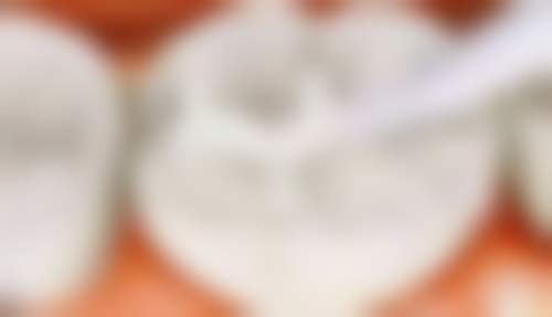 三河卡美口腔患者真实评价