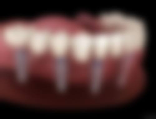 金华兰溪吕建中唯美口腔坐诊时间