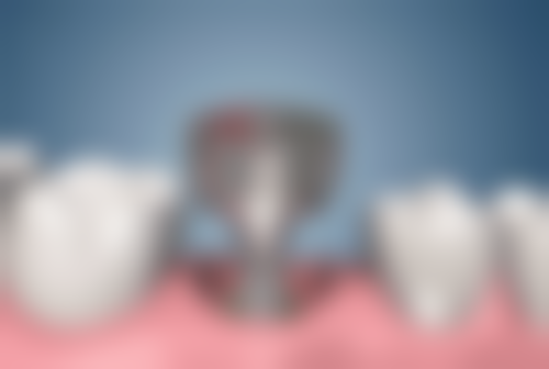 江苏南京爱美宁口腔的特色诊疗技术