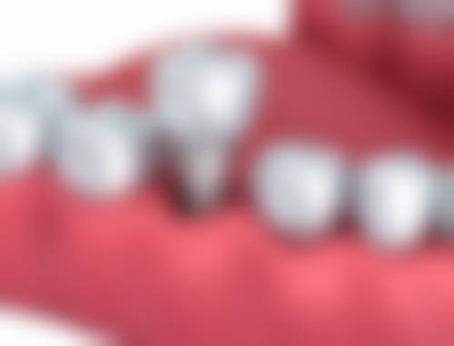 兰州固美口腔诊所患者真实口碑