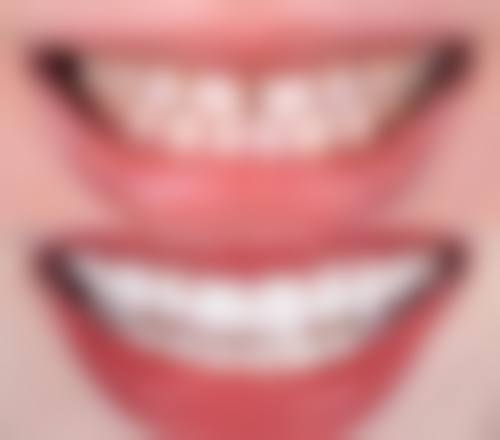 潍坊高新区新城口腔门诊部谷德茂店患者真实口碑