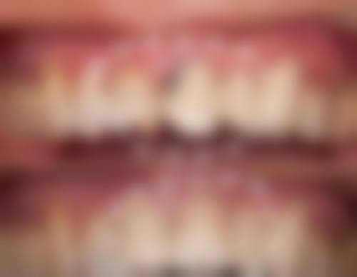 赖冬丽的临床实战与个性化诊疗