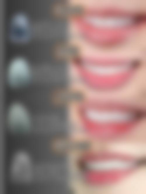 安徽亳州博雅口腔技术与设备优势