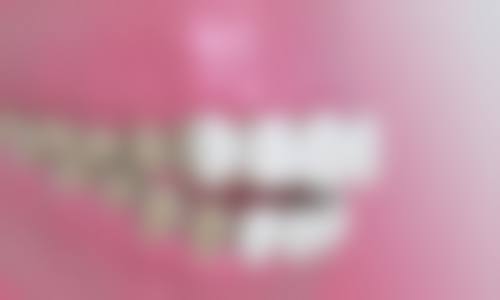 广州欣诚口腔门诊部特色诊疗技术