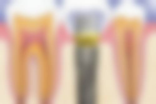 揭阳森麦口腔医院患者真实口碑