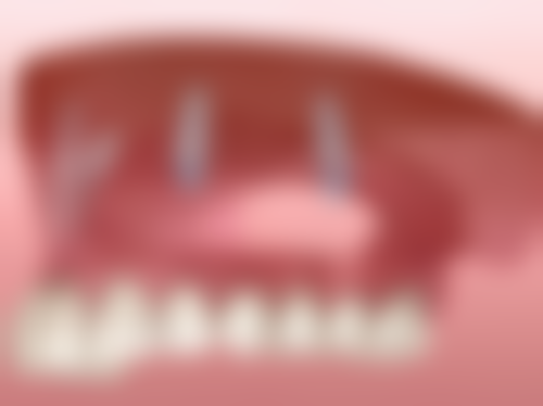 韩国Star21整形医院收费标准与透明化服务