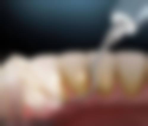 周村大染坊医院口腔科贴心服务与收费标准