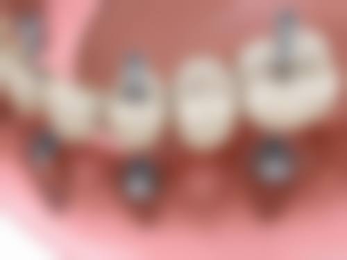 广东东莞如雅口腔门诊部患者真实评价