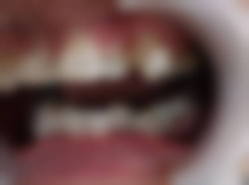 黄征难的临床实战与真实实例