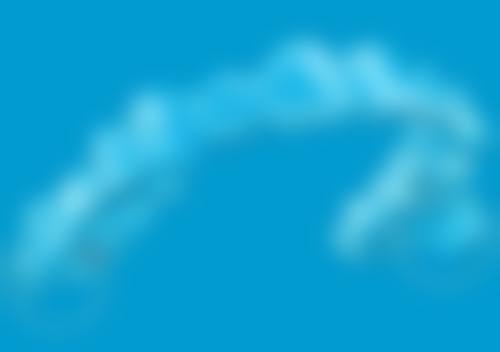 上海森朗口腔诊所特色种植技术