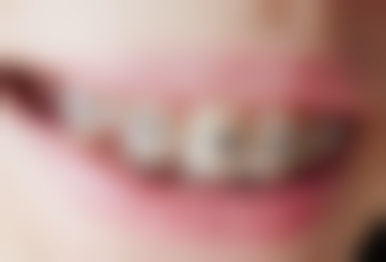 衢州柯城傅氏口腔诊所特色诊疗技术