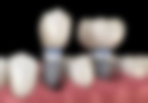 宁波镇海金丰一诺口腔门诊部医疗设备与就医体验