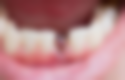 张可娟的临床实战与个性化诊疗