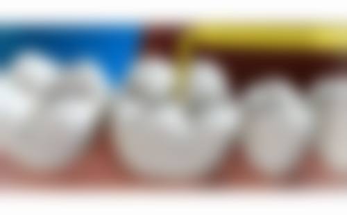 青岛齿泰口腔门诊部收费参考标准