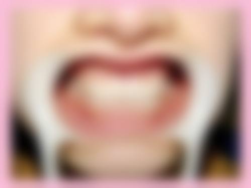 李惠 的临床实战与个性化诊疗