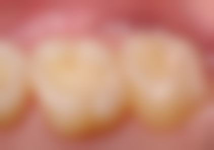 北京中 医 药大学附属护国寺中医医院口腔科 患者真实评价