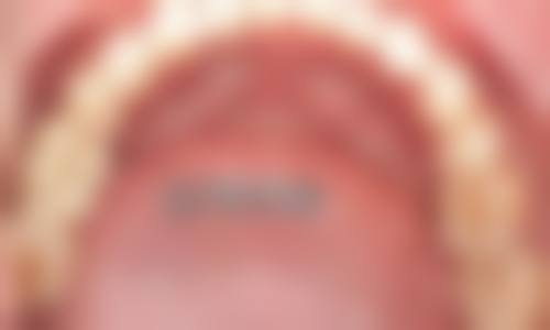 广州缪日高口腔门诊部收费参考标准