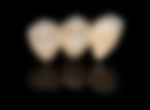 秦皇岛奥莱口腔诊所特色诊疗项目