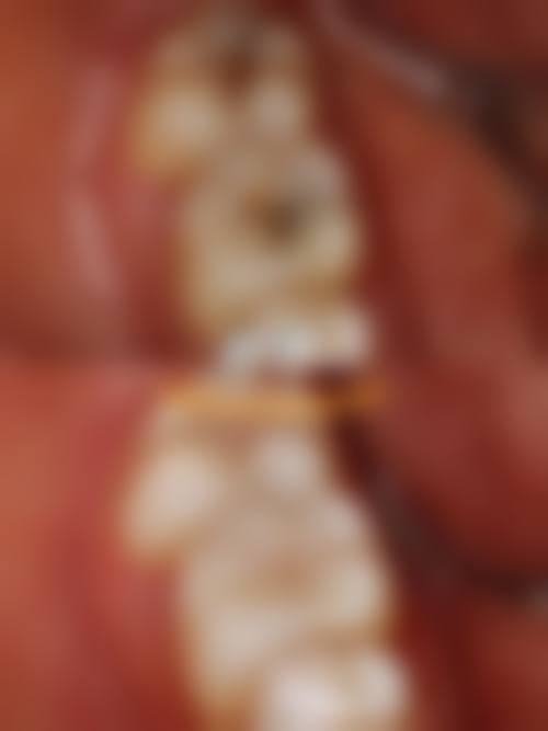 樊熊越的学术积累与诊疗质控