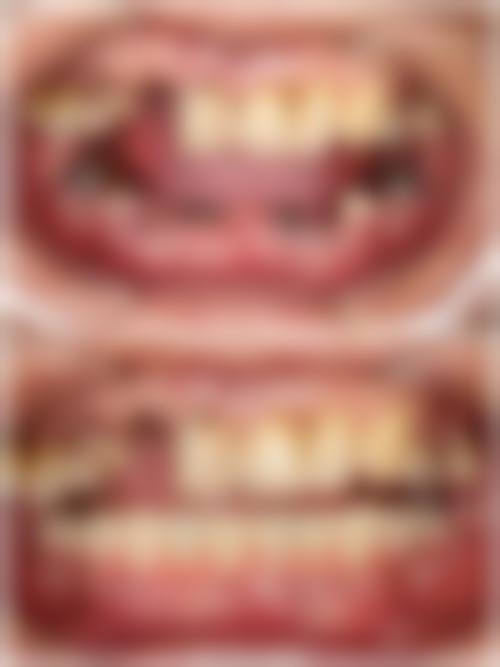 吴华伟的临床实战与个性化诊疗