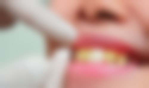 江苏连云港奥美口腔收费标准与价格说明