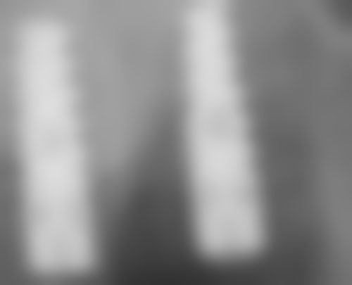 云南省红河州第三人民医院口腔科收费价格参考