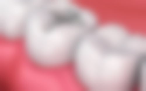 内蒙古牙克石市李欣口腔特色诊疗技术