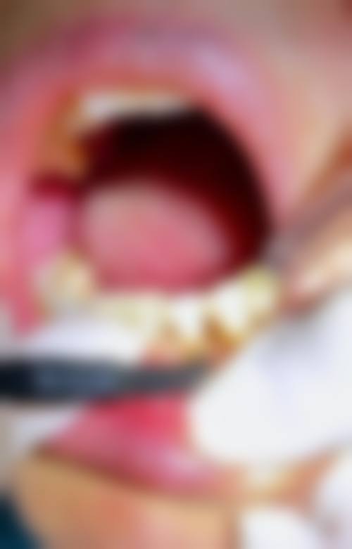 吴忠牙卫士口腔收费价格标准