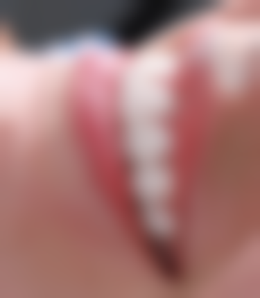 广州繁华路健恩口腔门诊部特色诊疗技术