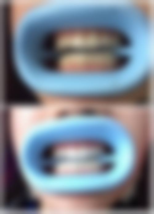 河南大学赛思口腔医院收费价格参考