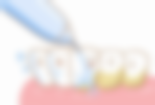 云南大理祥云愽爱口腔医院口腔科患者真实评价