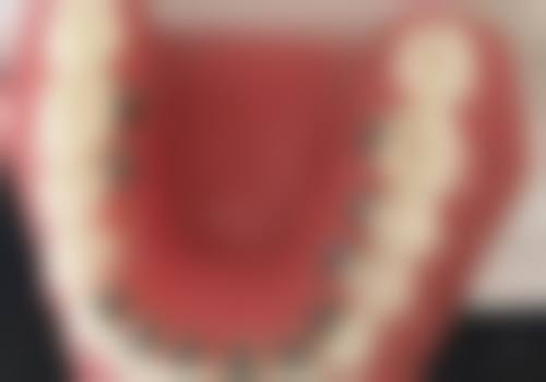 贵阳富林口腔医院患者真实反馈