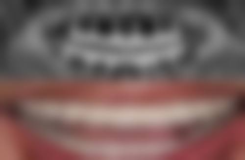 南昌市第一医院口腔科精良设备与特色技术