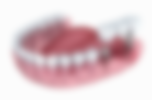 赵建安的临床实战与个性化方案