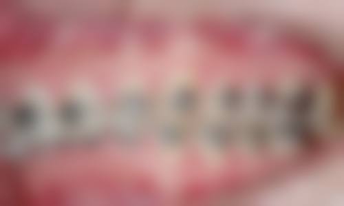 郭邑隆的临床实战与个性化诊疗